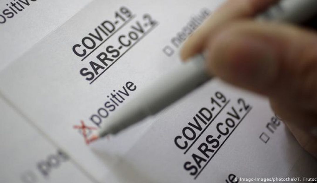 Por error 110 personas fueron reportadas como positivas para COVID en Ocaña Por error 110 personas fueron reportadas como positivas para COVID en Ocaña