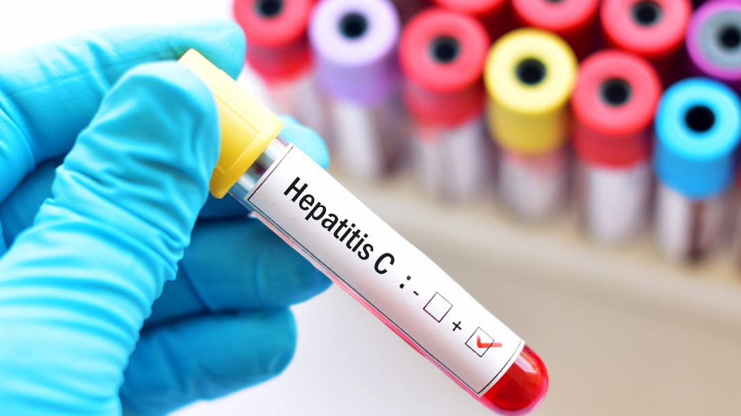 Colombia adquirió más de 1.000 tratamientos para la Hepatitis C