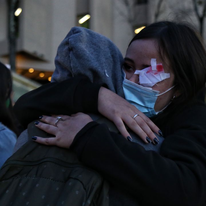“Van 90 personas con lesiones oculares durante las protestas”