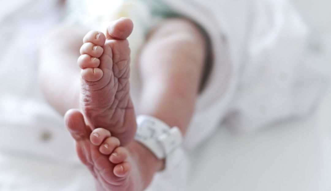 1 de cada 3 niños con paladar hendido también sufre de desnutrición 1 de cada 3 niños con paladar hendido también sufre de desnutrición