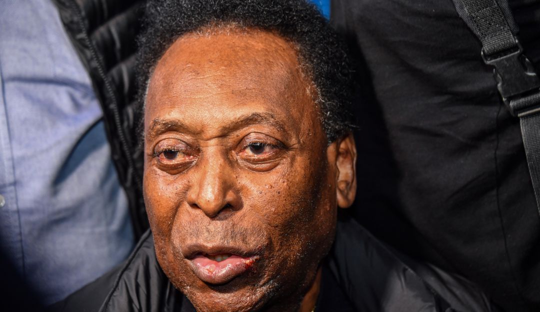 Pelé se encuentra hospitalizado desde finales de agosto. Pelé se encuentra hospitalizado desde finales de agosto.