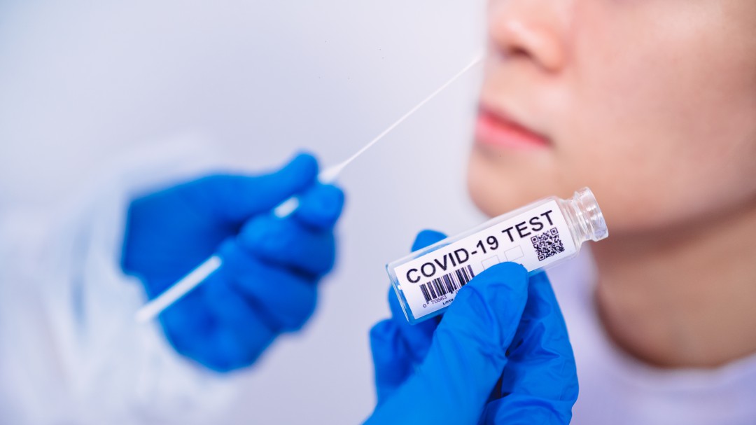 COVID-19 en Colombia: Se confirmaron 1.702 nuevos contagios y 36 muertes