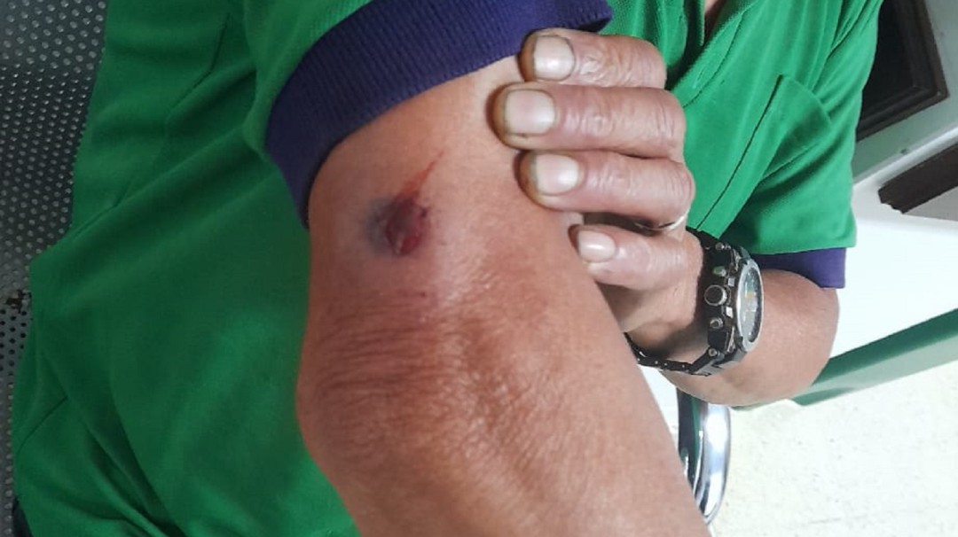 En Pácora, hombre fue herido en su brazo, al parecer con un arma traumática