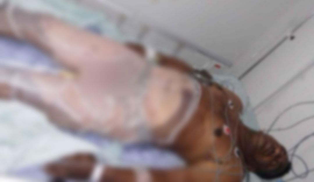 Agresiones en el Magdalena: En el Magdalena, mujer le quema con agua caliente el pene a su esposo Agresiones en el Magdalena: En el Magdalena, mujer le quema con agua caliente el pene a su esposo