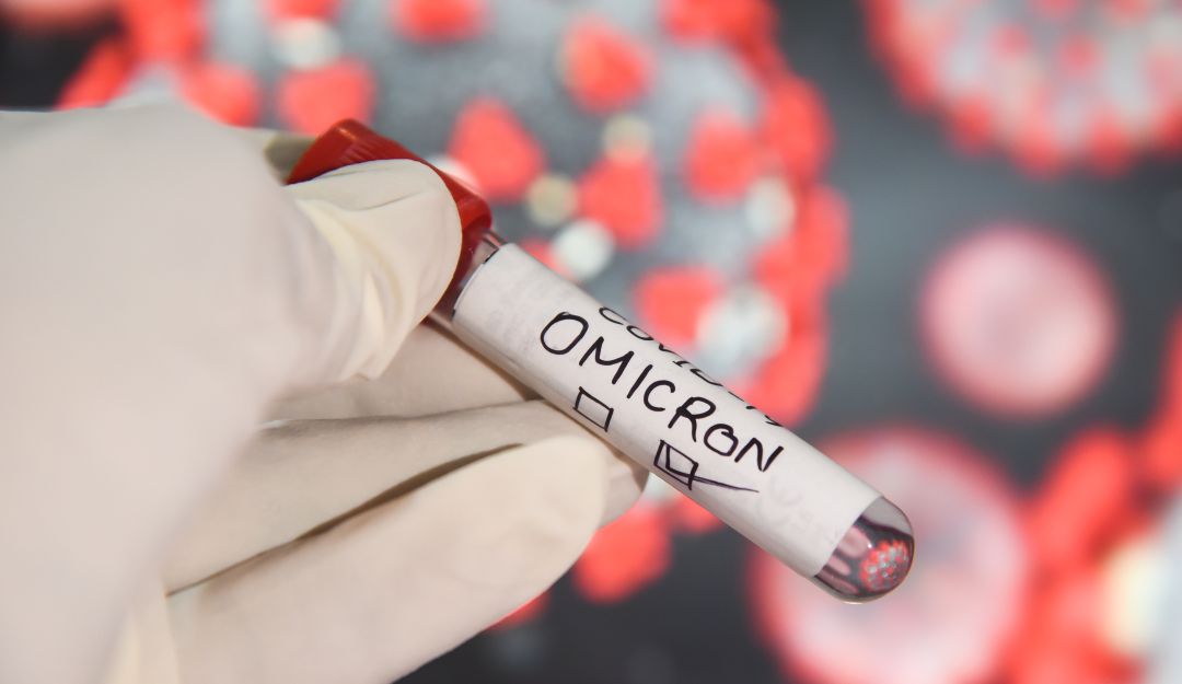 Ómicron: Síntomas que pueden indicar que tiene el virus Ómicron: Síntomas que pueden indicar que tiene el virus