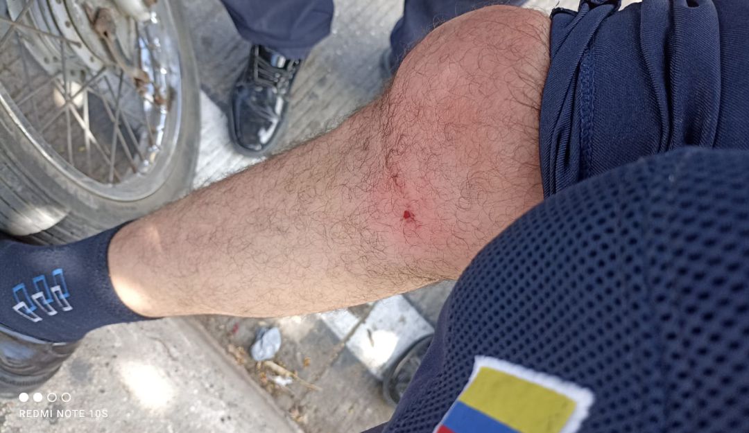 El hecho se registró en el sector de la Plaza de Toros en medio de operativos de control El hecho se registró en el sector de la Plaza de Toros en medio de operativos de control