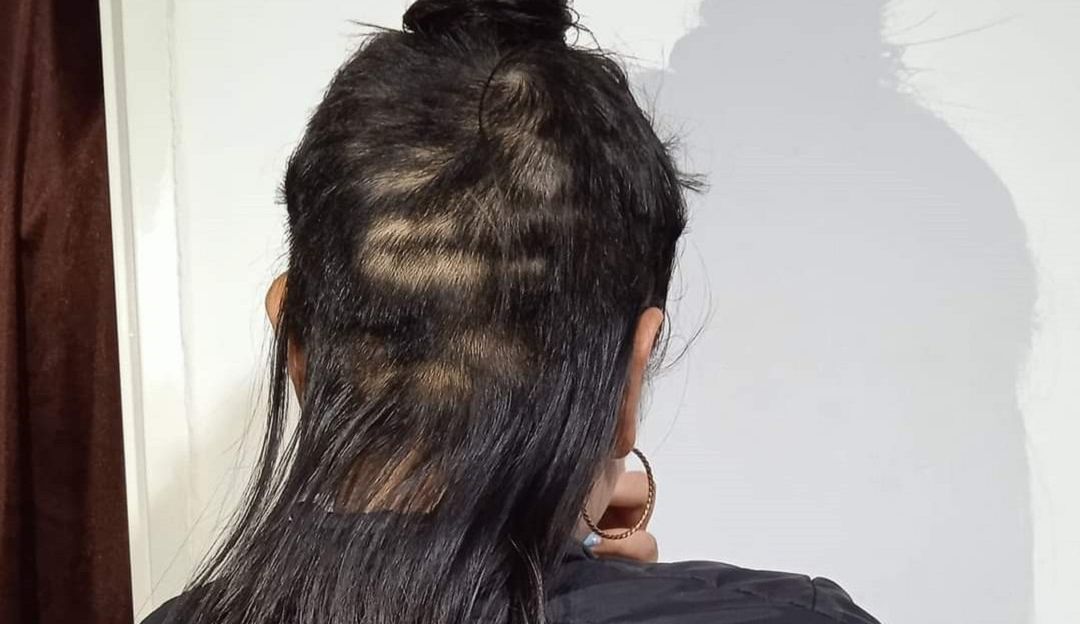 Adolescente de 17 años de edad fue víctima del hurto de gran parte de su cabello Adolescente de 17 años de edad fue víctima del hurto de gran parte de su cabello