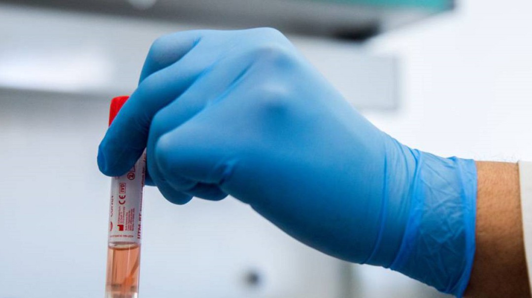 Variante Ómicron generó disparo de casos COVID en Quindío: Epidemióloga