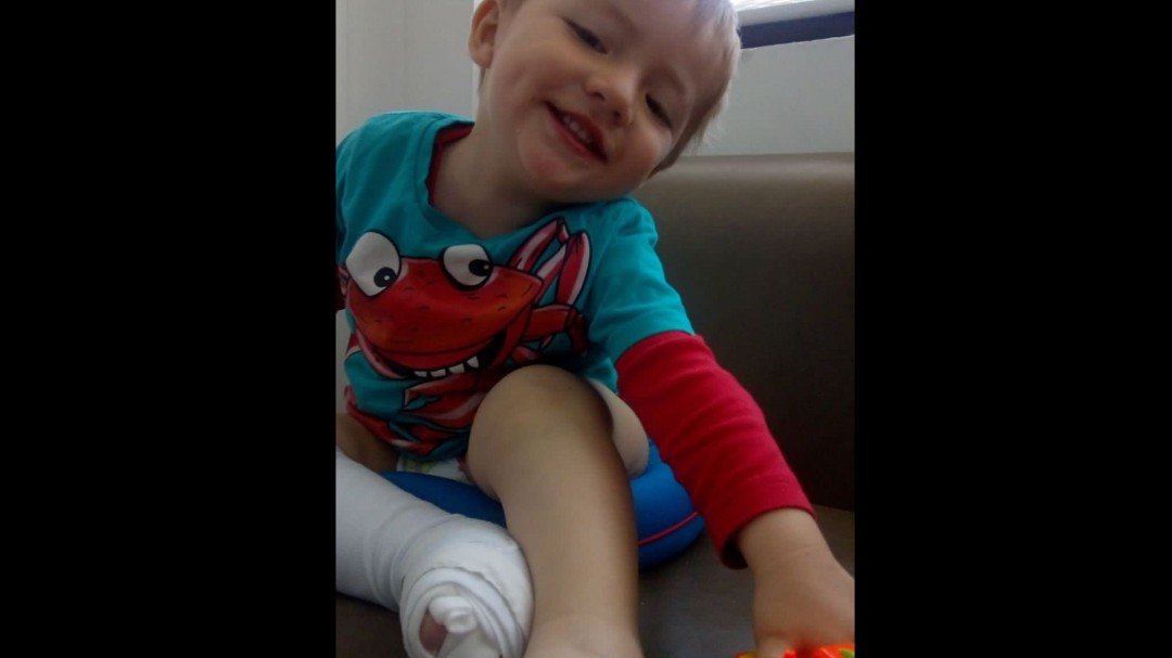 Así puede donar a la recuperación de Ignacio, niño con Síndrome de Cloves