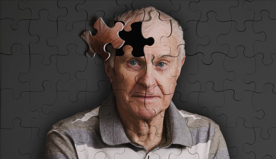 Alzheimer Alzheimer