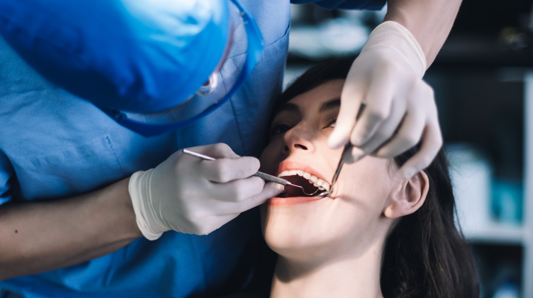 Caries: A pesar de cepillarse los dientes, se puede tener este problema