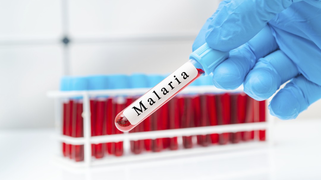 Vacuna colombiana contra la Malaria mostró una efectividad del 60%