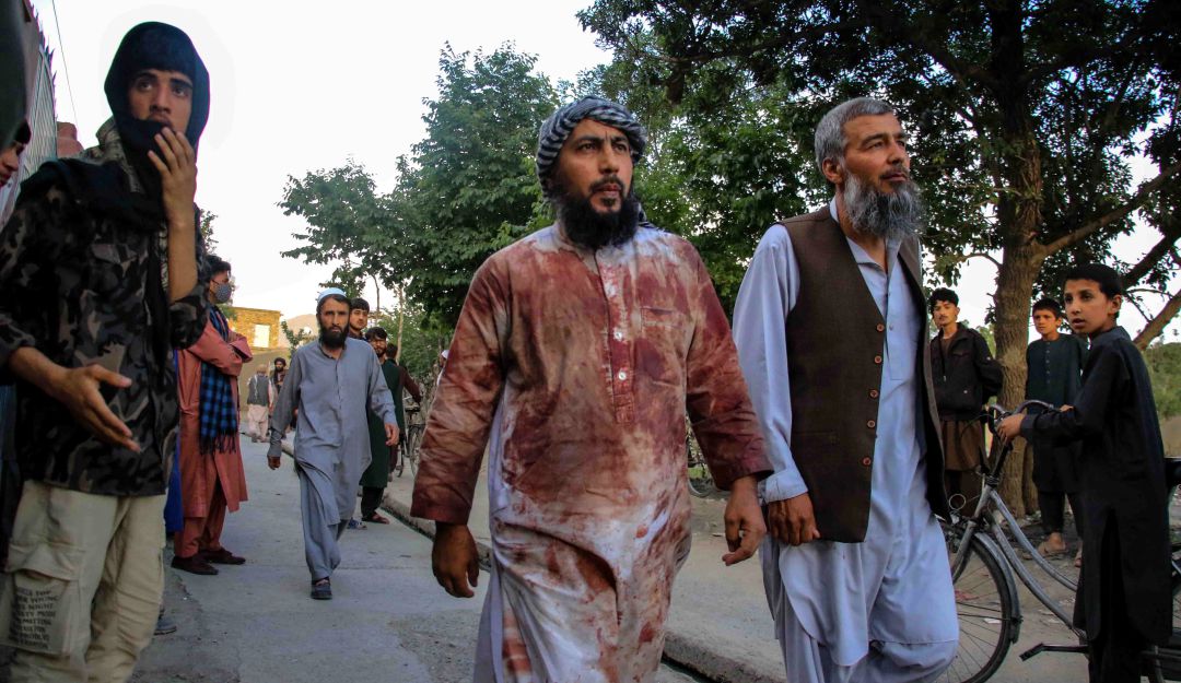 Explosión en Kabul deja al menos 50 muertos Explosión en Kabul deja al menos 50 muertos