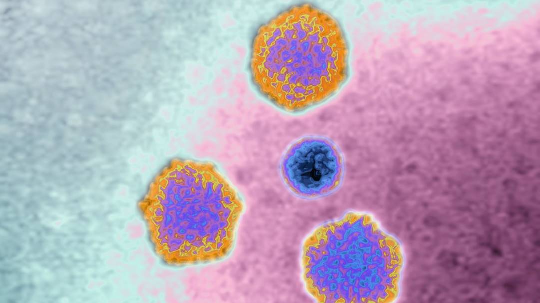 Un virus sería la causa de casos de hepatitis misteriosa en niños