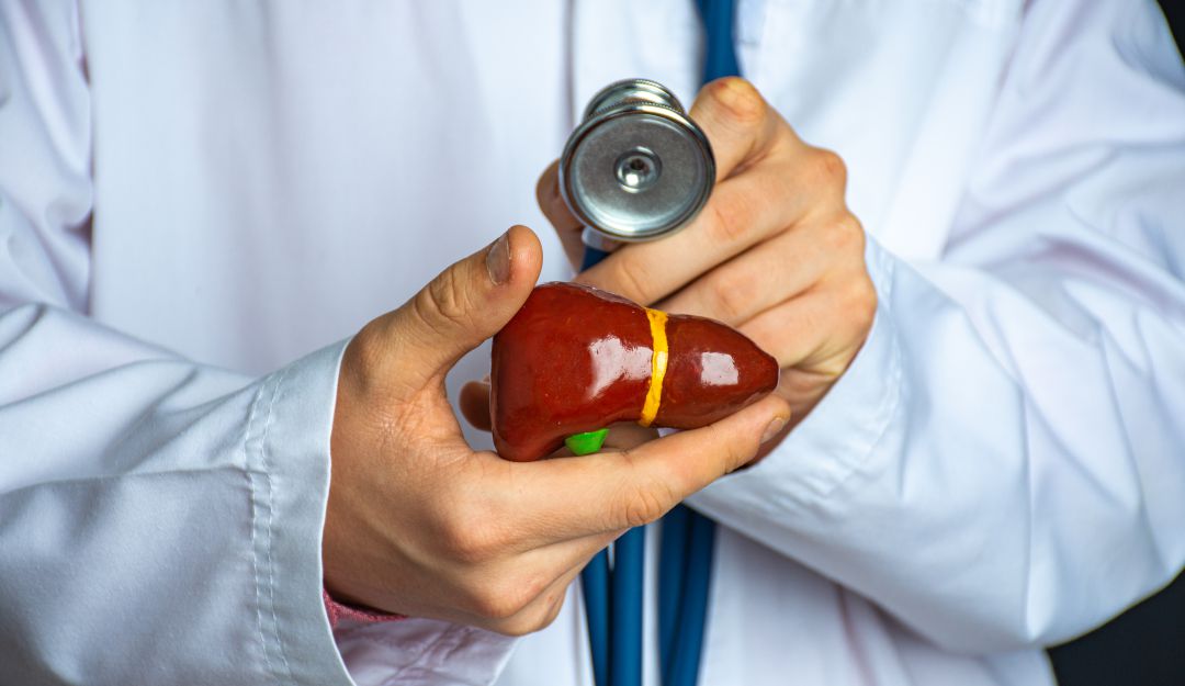 Hepatitis Hepatitis