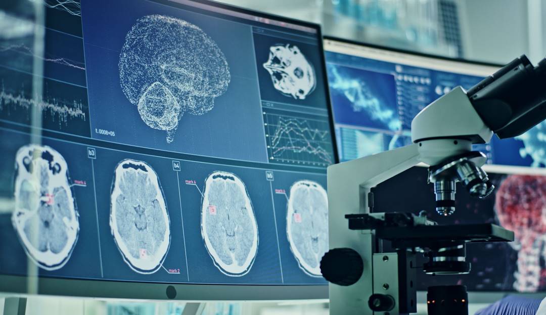 Análisis de situación cerebral de las personas contagiadas con coronavirus. Foto: Getty Análisis de situación cerebral de las personas contagiadas con coronavirus. Foto: Getty