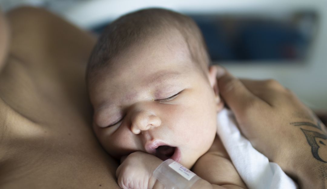 Síndrome de muerte súbita del lactante afecta a 1 de cada 1.000 nacimientos Síndrome de muerte súbita del lactante afecta a 1 de cada 1.000 nacimientos