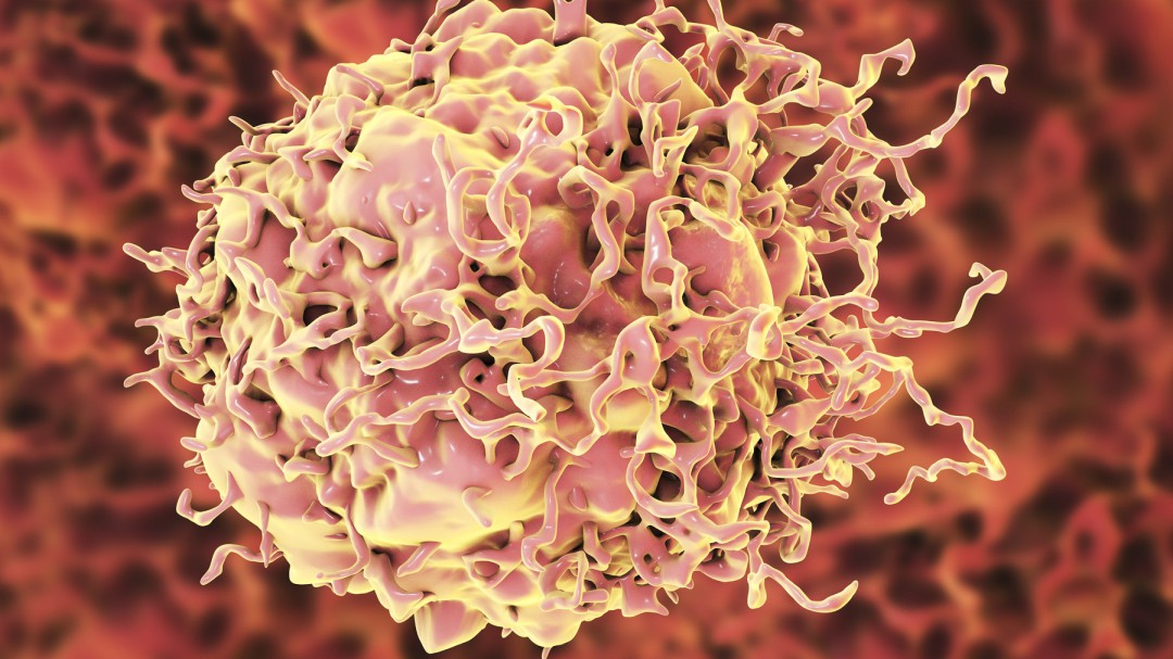 Un fármaco logró desaparecer el cáncer de colon en un grupo de pacientes