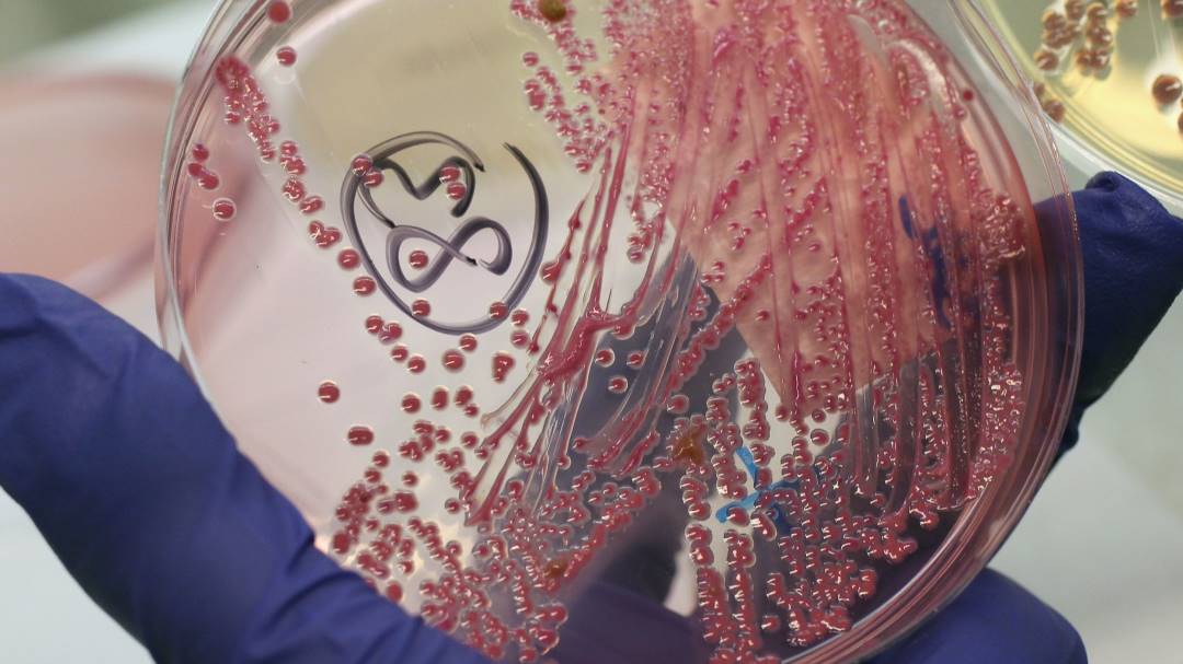 Detectan bacteria que causa enfermedad potencialmente mortal en EE.UU.