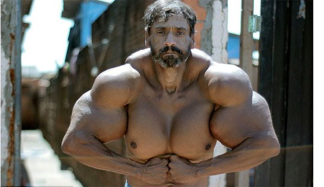 Murió el "Hulk brasileño" por aumentar sus músculos con aceite Murió el "Hulk brasileño" por aumentar sus músculos con aceite