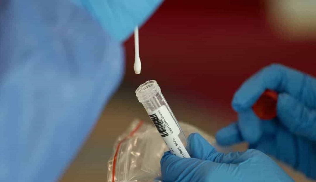 En la región fueron notificados cinco muertes a causa del virus. En la región fueron notificados cinco muertes a causa del virus.