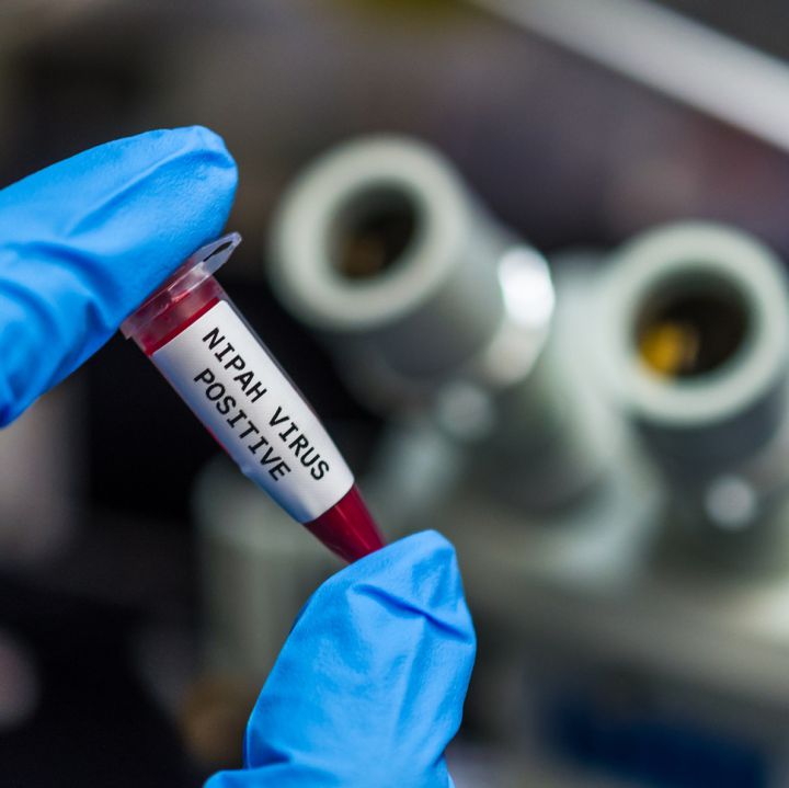 Henipavirus hoy: ¿Qué tan mortal es este nuevo virus de China?