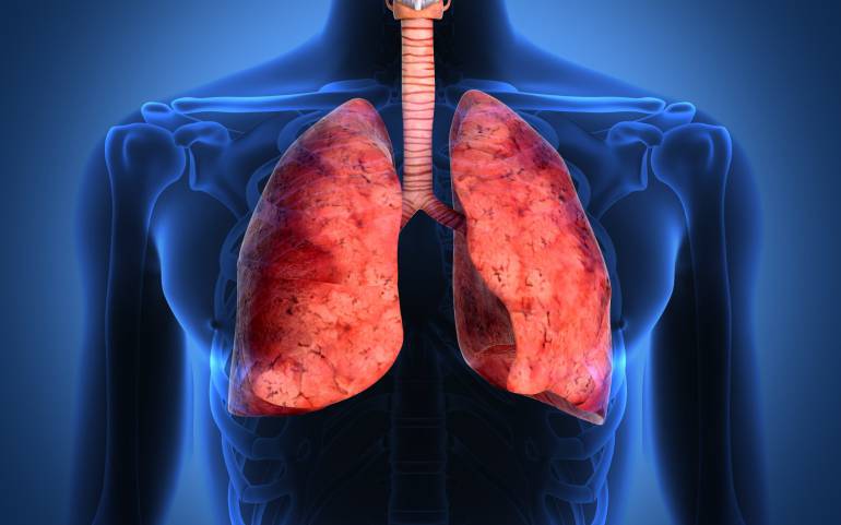 Cáncer de pulmón: su única causa no es el tabaquismo | Sanamente ...