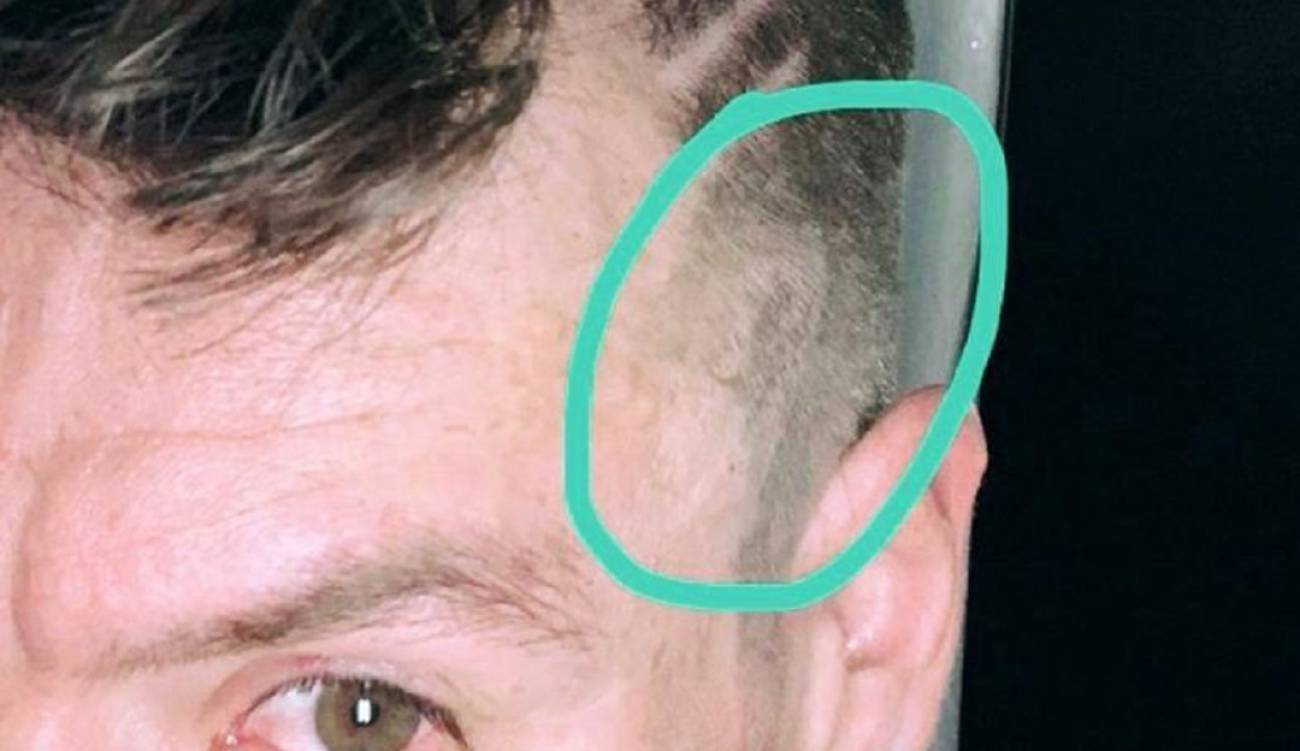 Corte de pelo Rigoberto Urán esposa: Le "sacaron la piedra ...