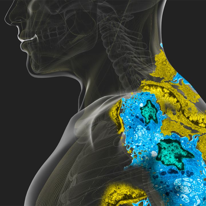 Retiro voluntario de producto farmacéutico del mercado