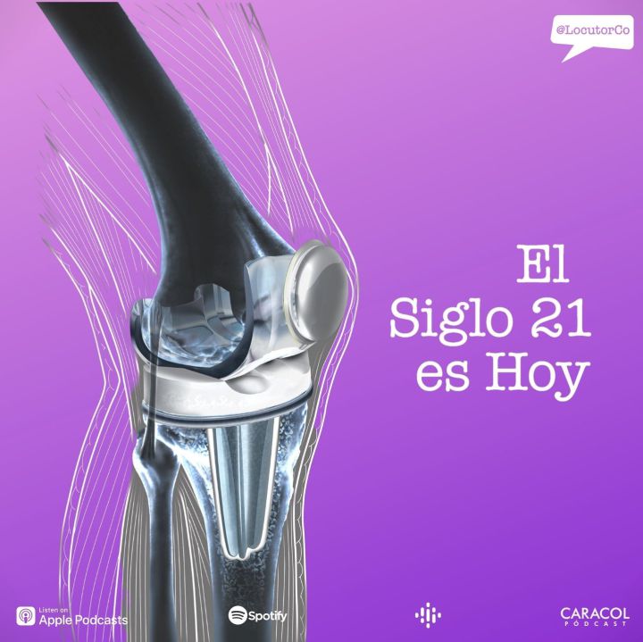 Impresión 3D en Titanio